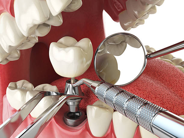 Best Broken Tooth Emergency  in Titusville, PA